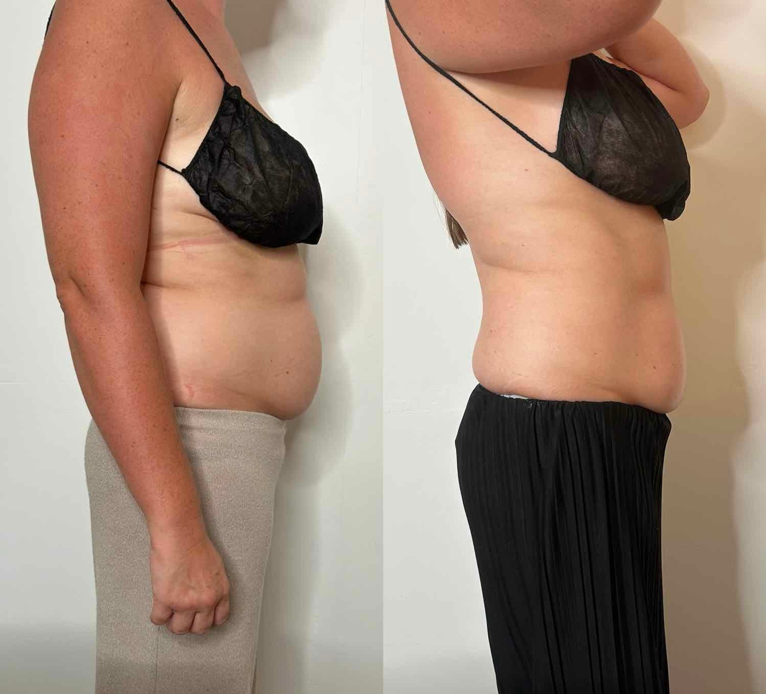 Before and After Transformation 10