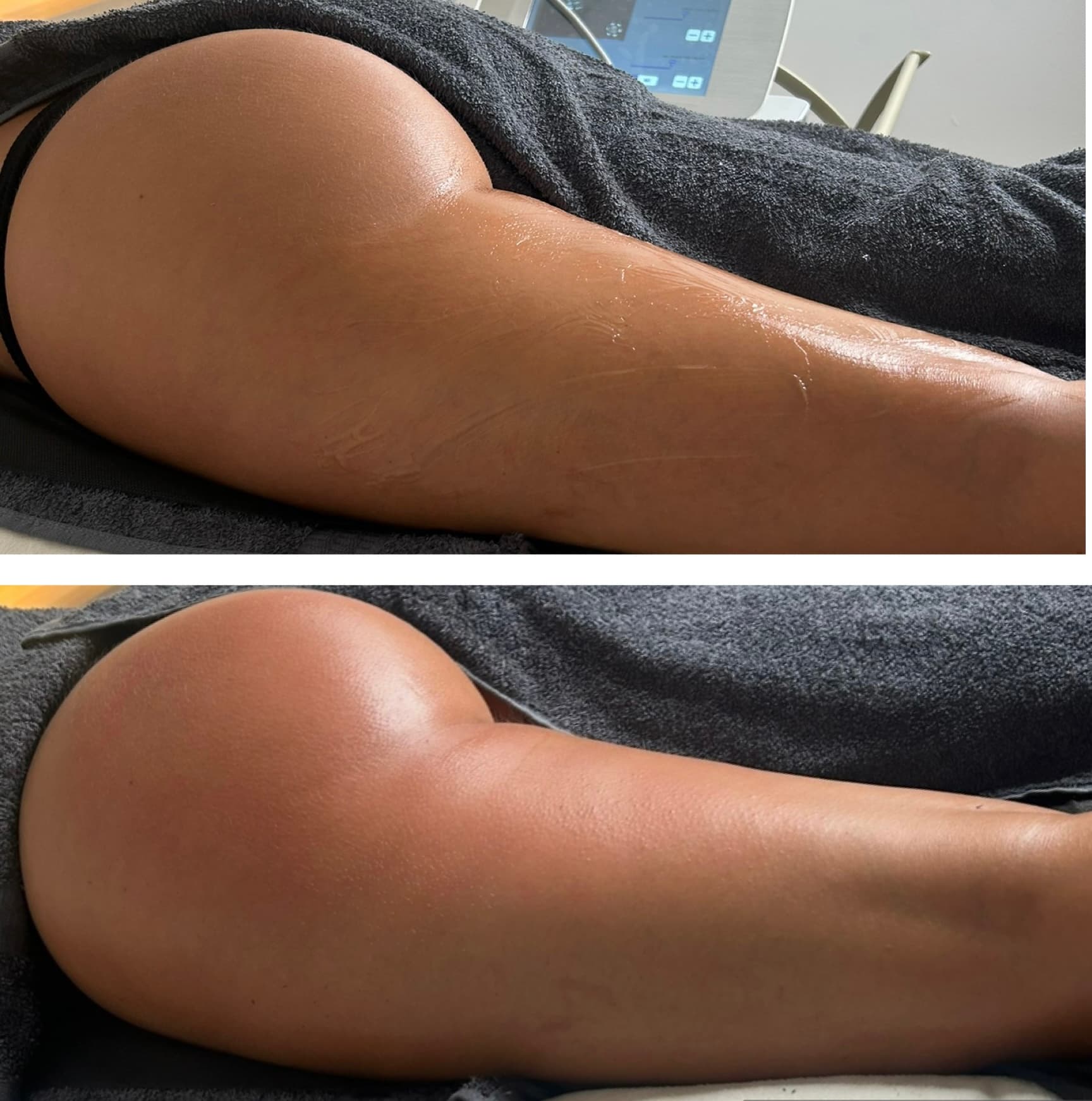 Before and After Transformation 11