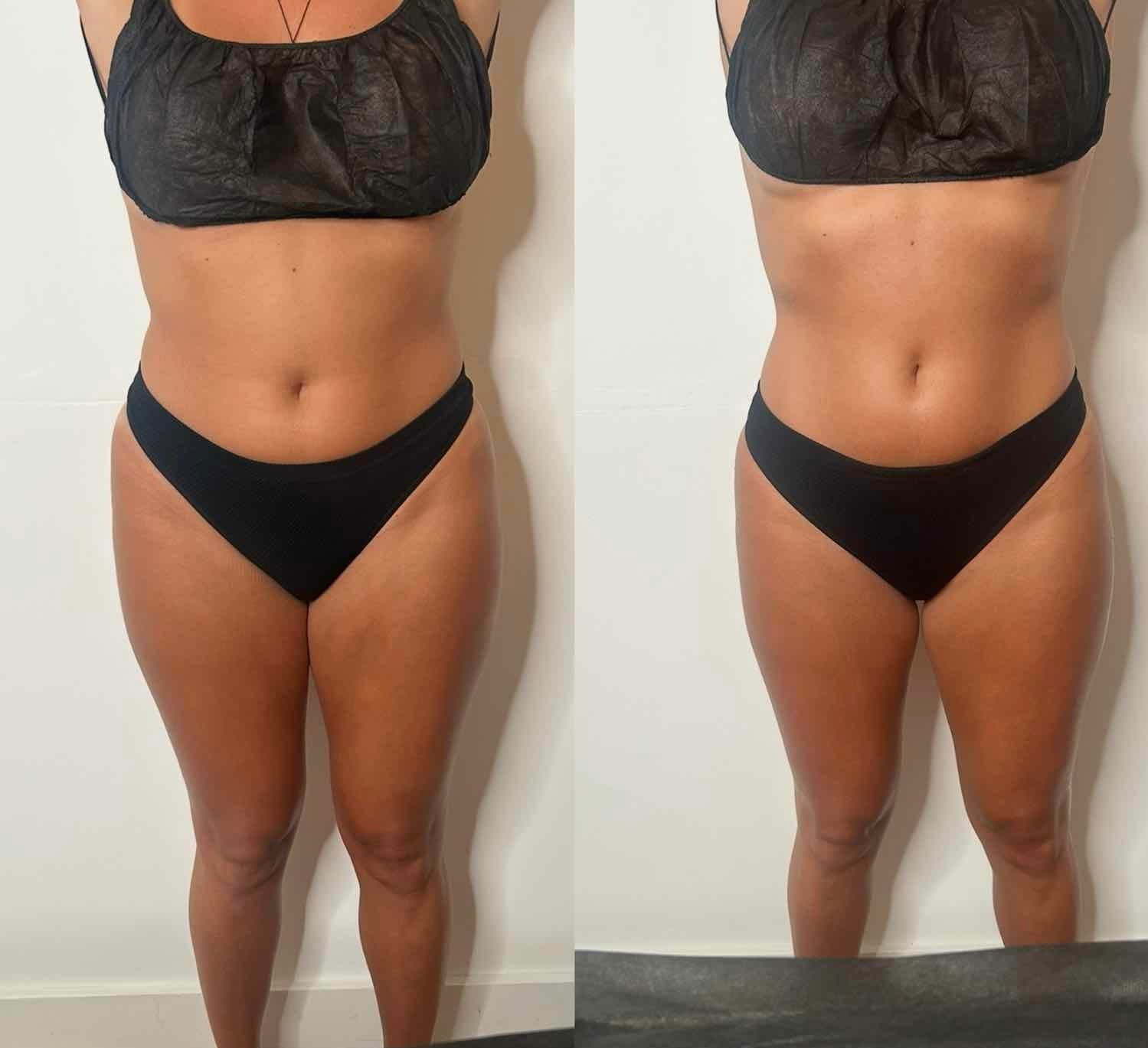 Before and After Transformation 12