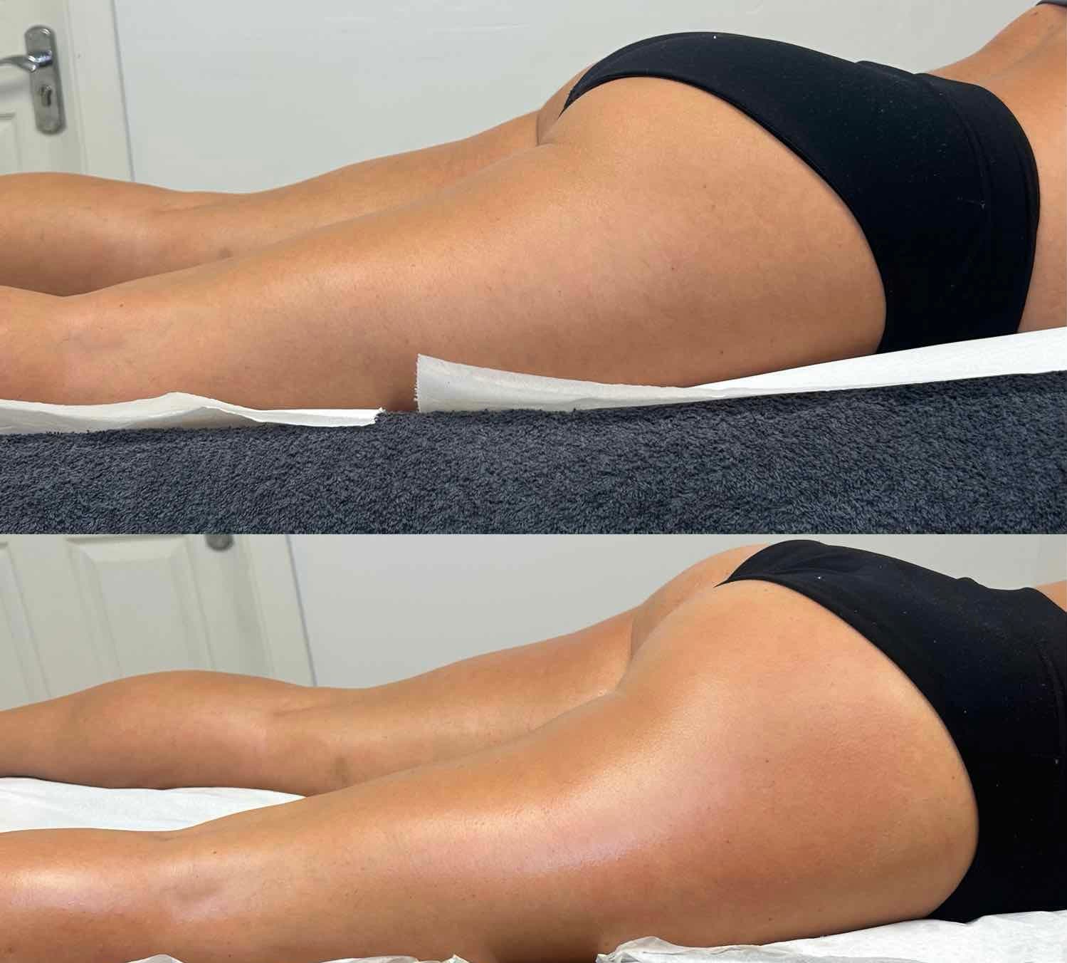 Before and After Transformation 2