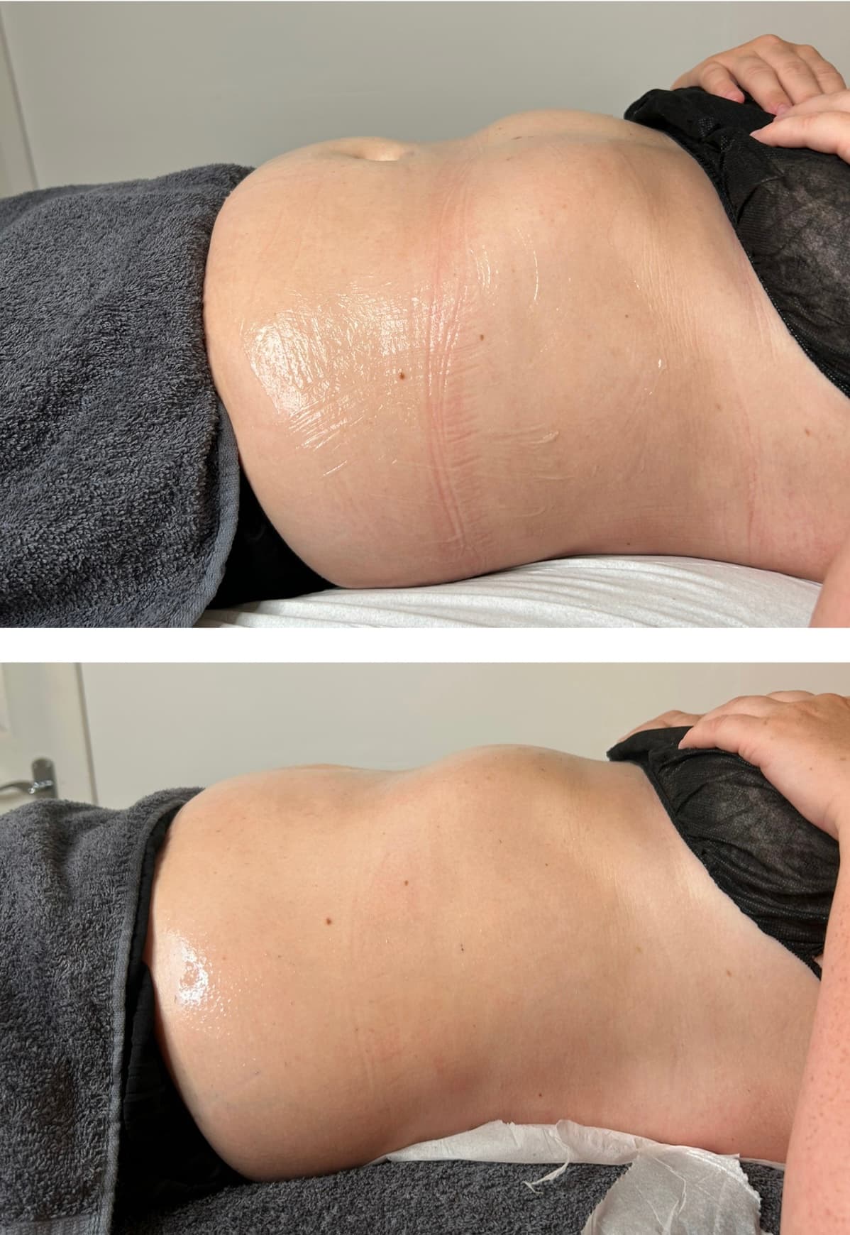 Before and After Transformation 4