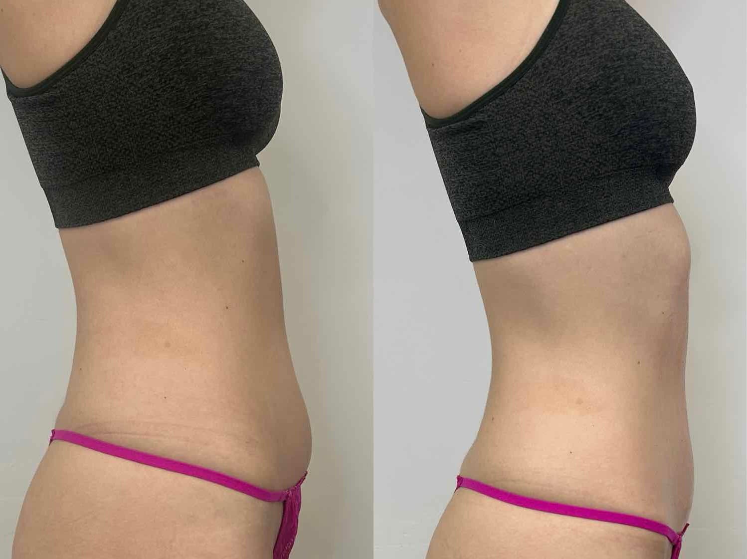 Before and After Transformation 6