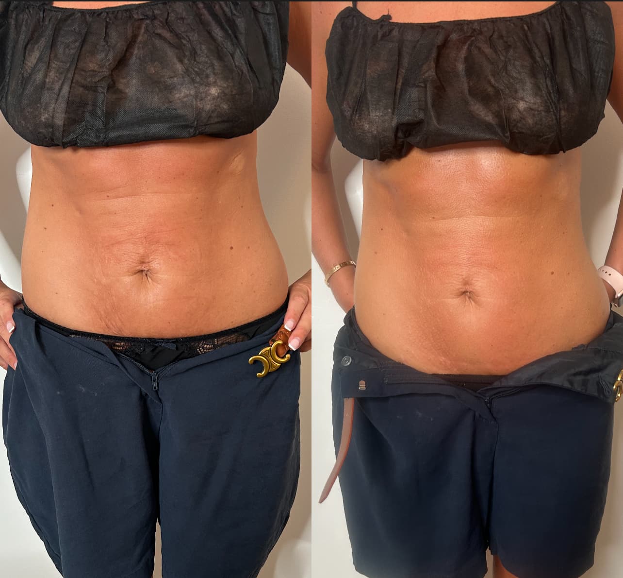 Before and After Transformation 8