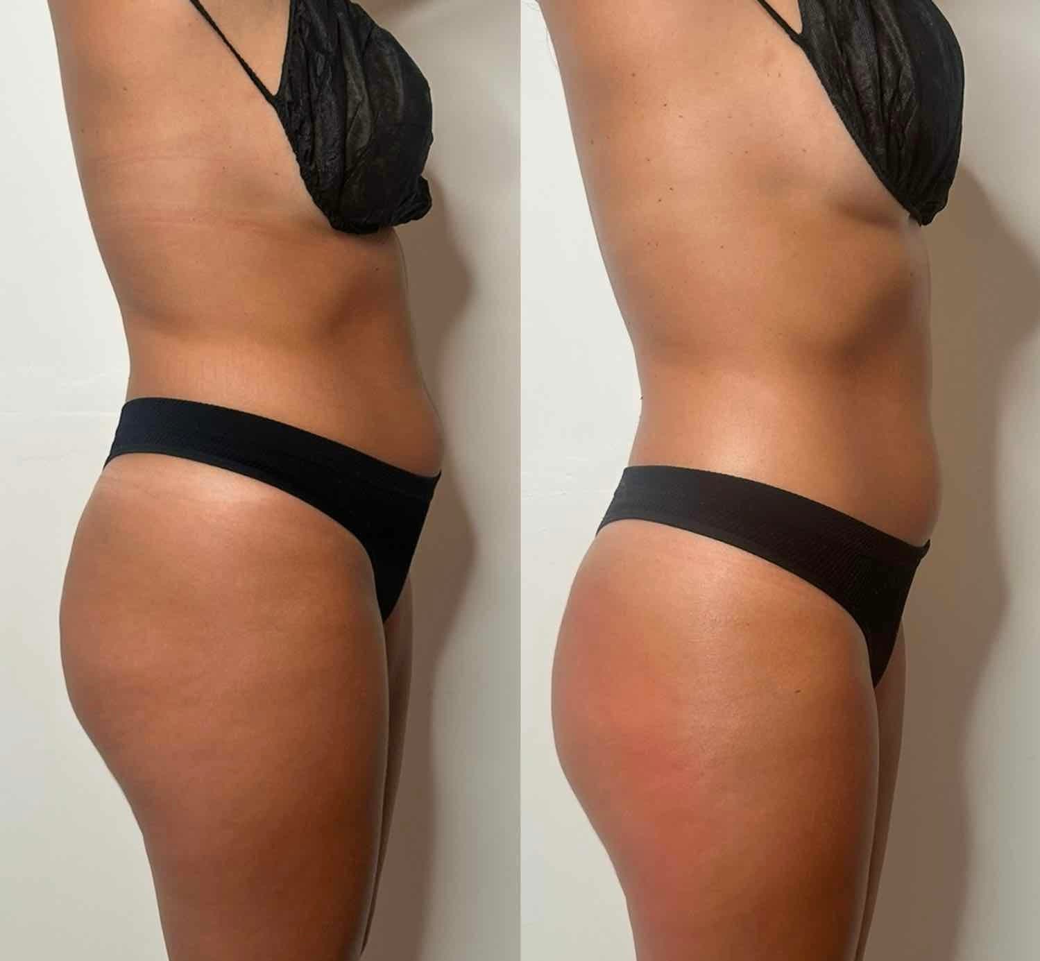 Before and After Transformation 9