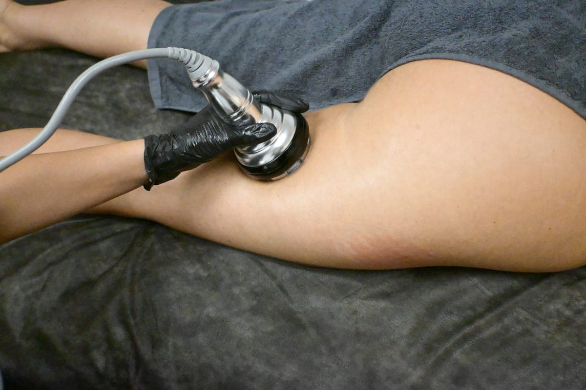 Ultrasonic Cavitation